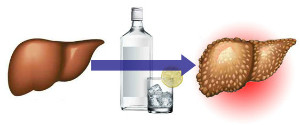 воздействие алкоголя на печень